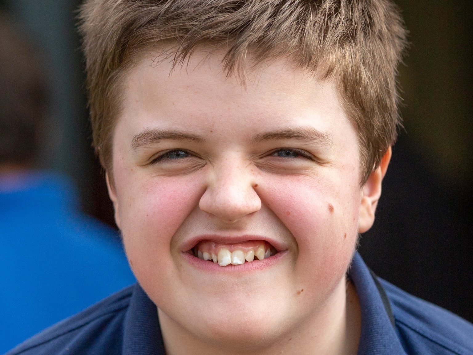 Teenage boy with a disability school photograph